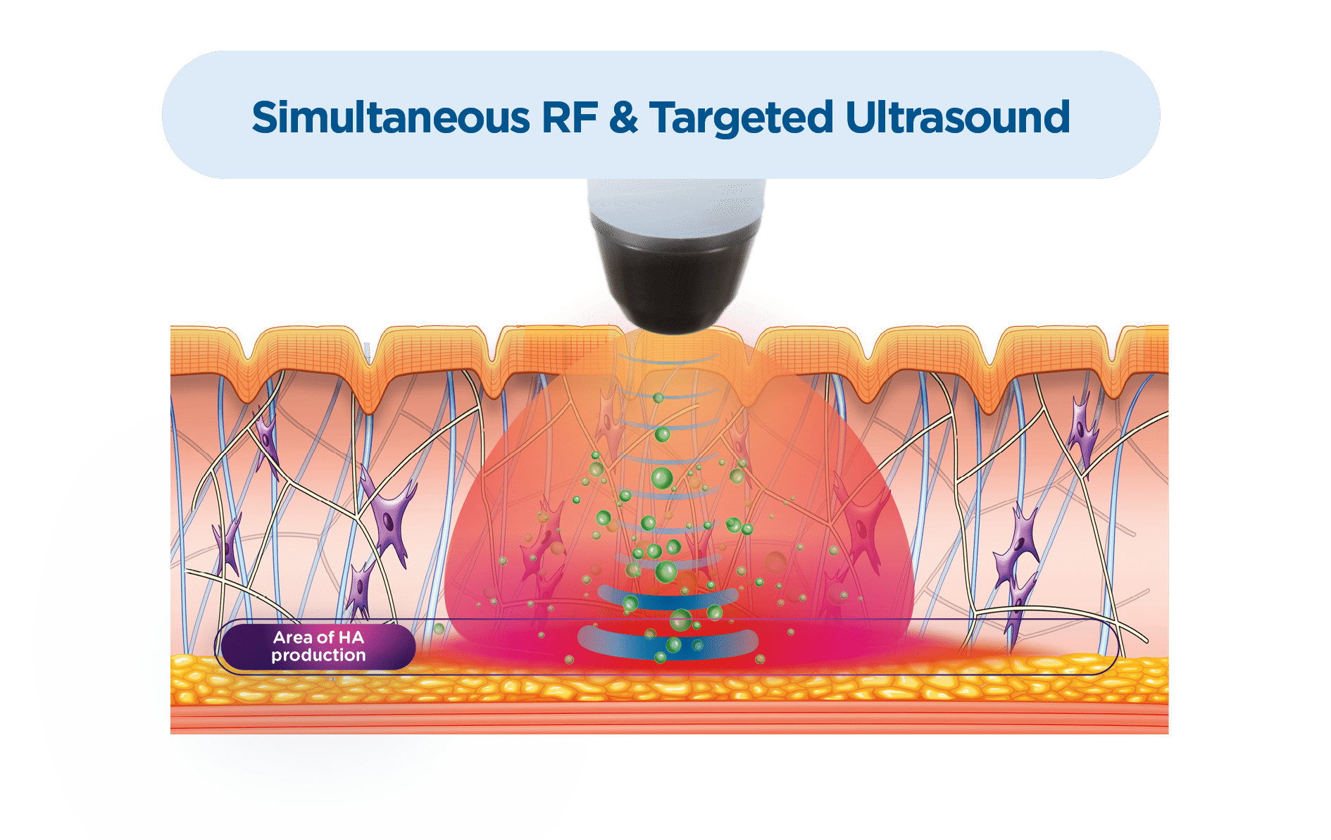 1768248500_Exion_PIC_MOA_Face_ENUS100