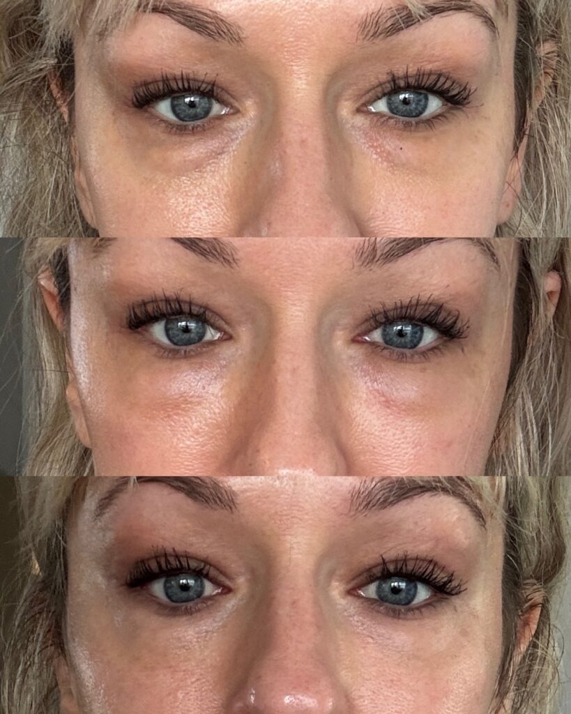 Before and After Image: EZ Gel - front