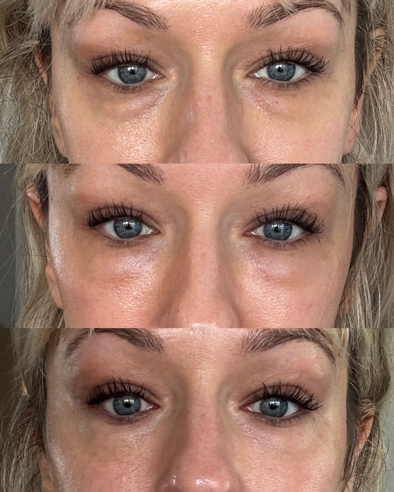 Before and After Image: EZ Gel - front