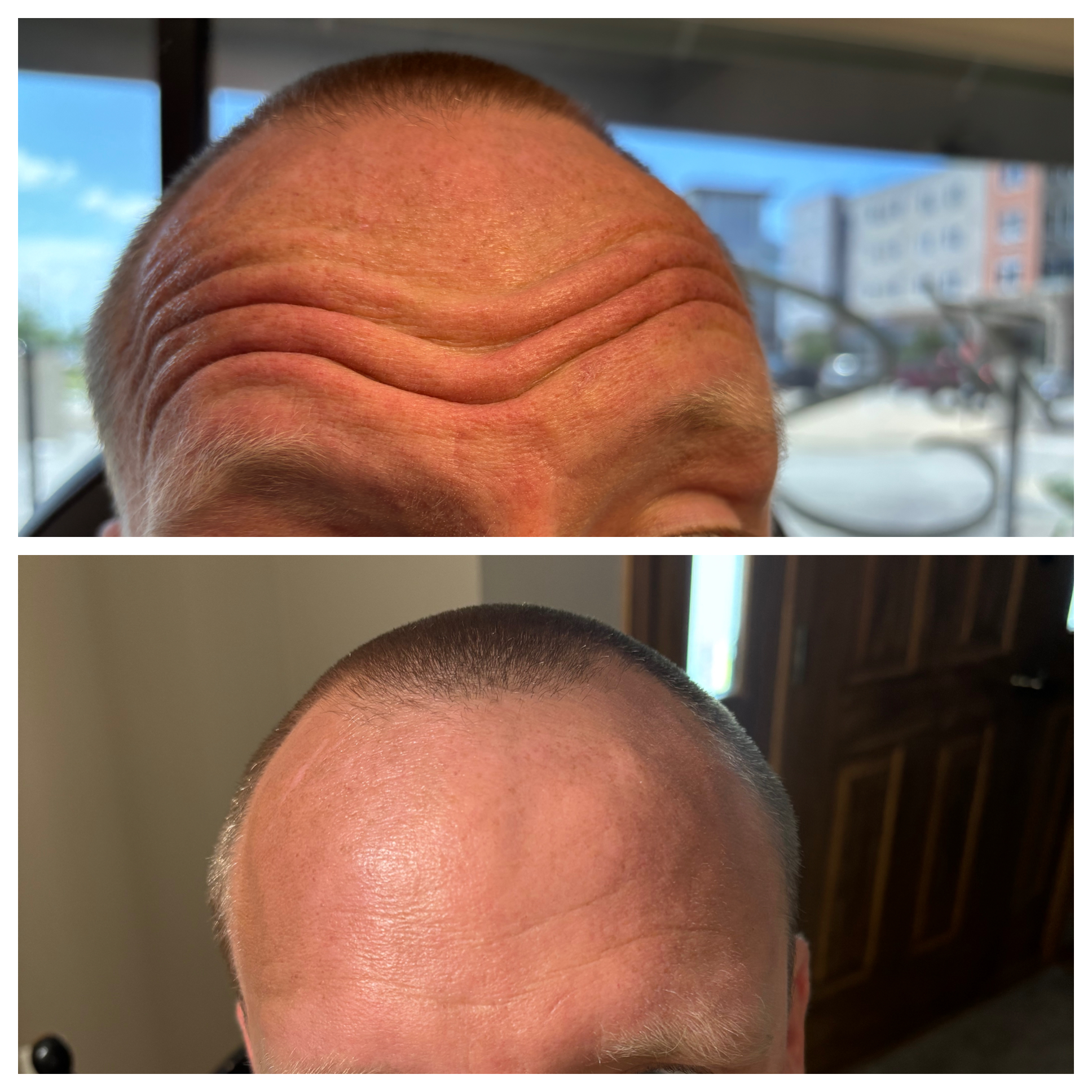 Before and After Image: Letybo - front