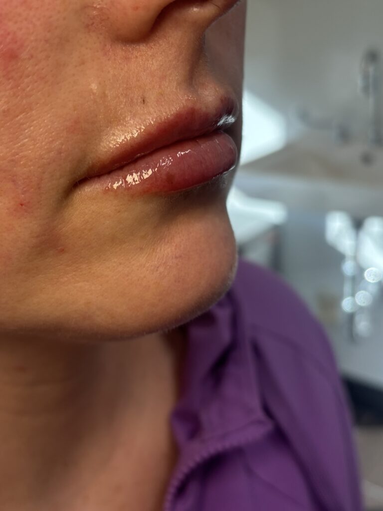 EZ Gel in West Des Moines, IA