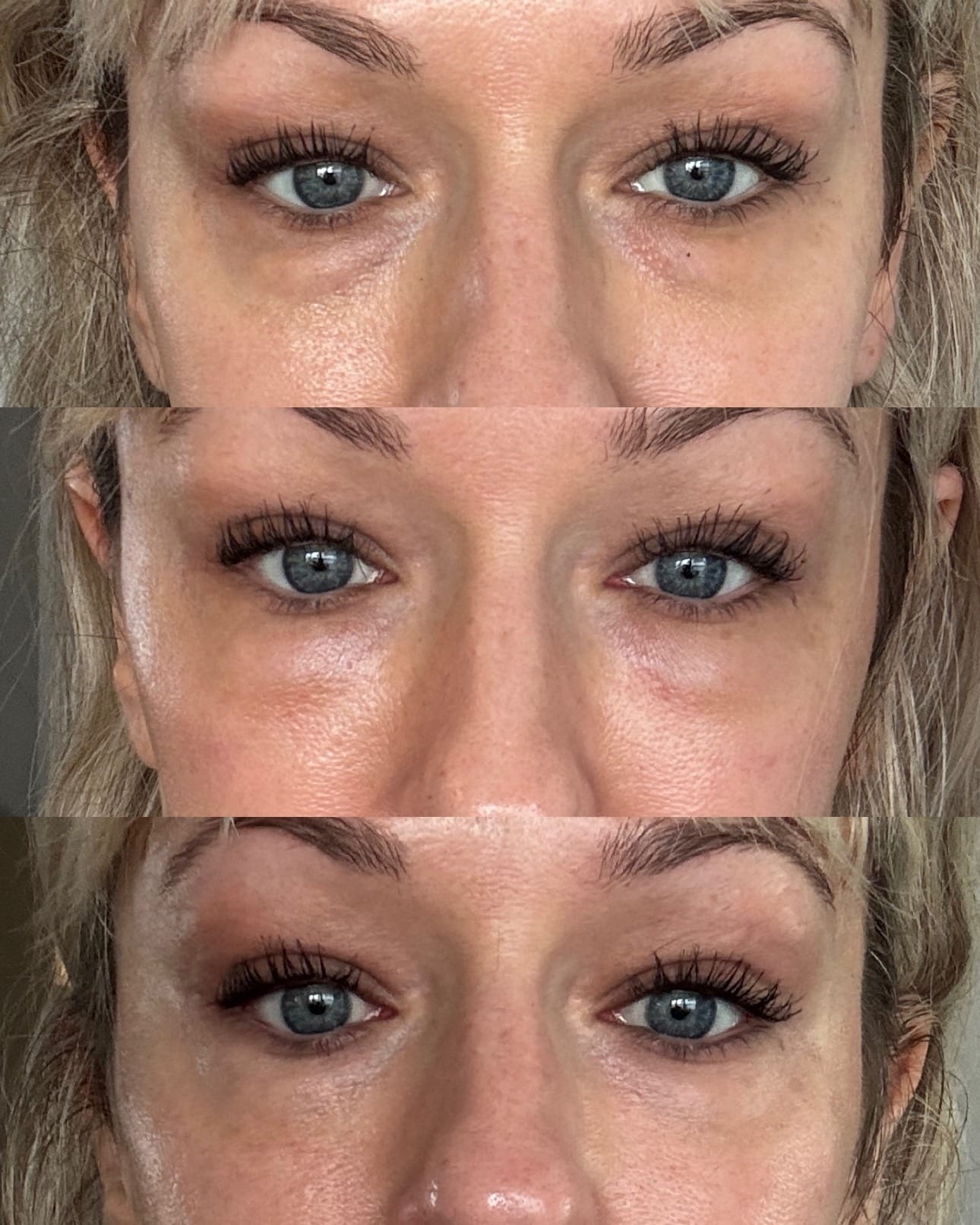 Before and After Image: EZ Gel - front