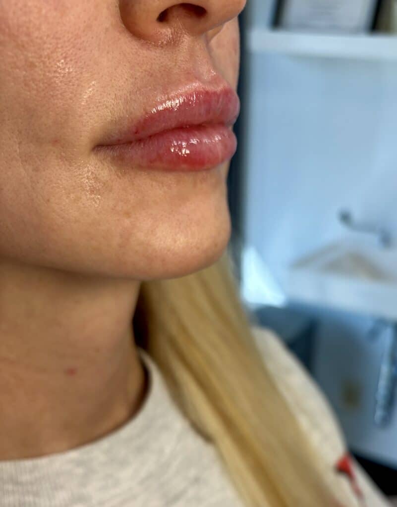 EZ Gel in West Des Moines, IA