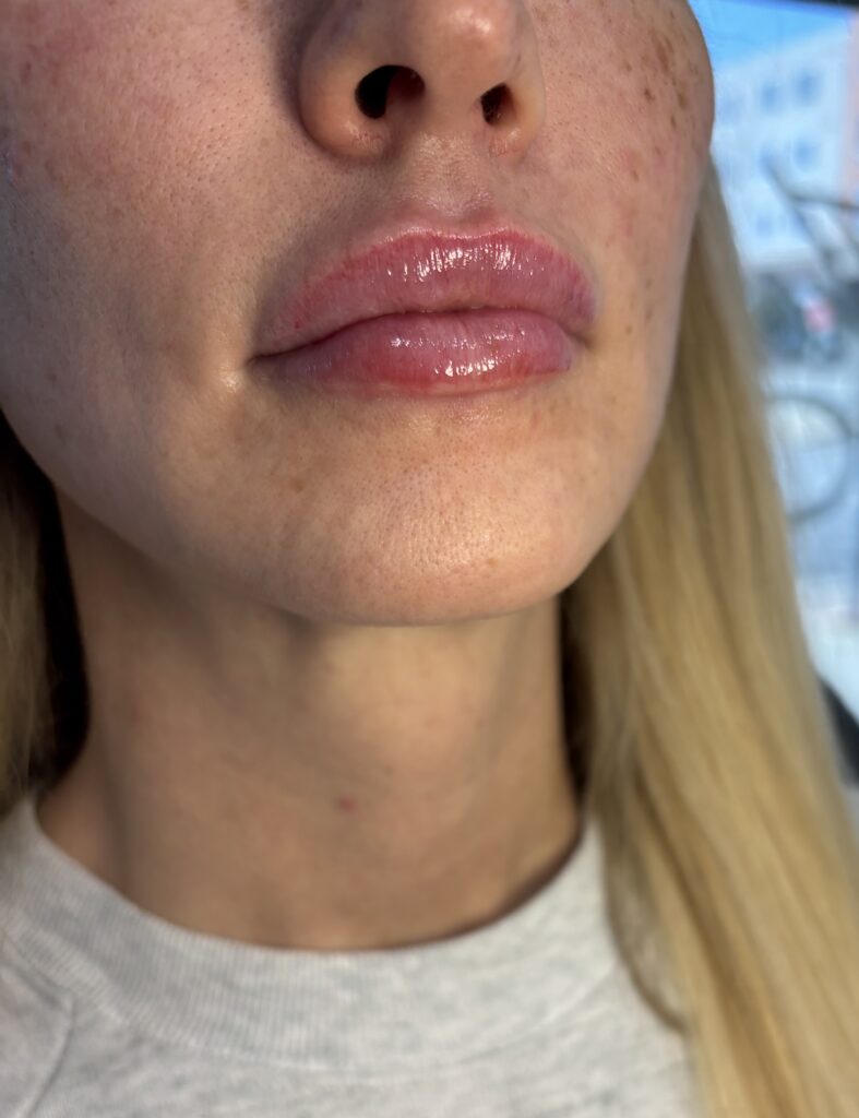 EZ Gel in West Des Moines, IA